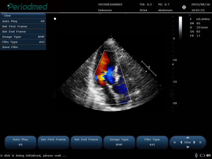 ç¸æ§éµæ¢å¤´-å½©è²å¤æ®åæ¨¡å¼-å¿è Phased Array Probe-Color Mode-Cardiac3